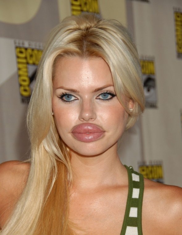 21 Disasters of Plastic Surgery