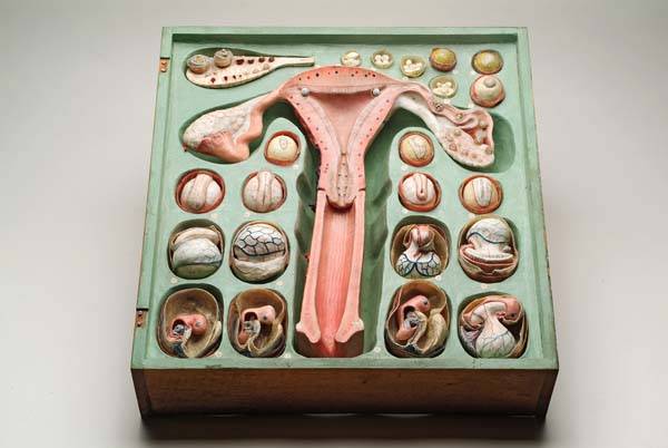 The handiwork of Dr. Louis Auzoux—a paper mache gynecological model circa 1880.