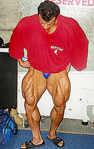 When Bodybuilding and Steroids Go Too Far