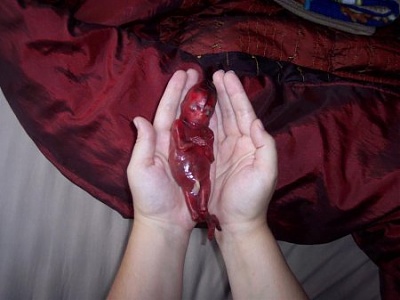 DISTURBING!! Mother has miscarriage and keeps it!