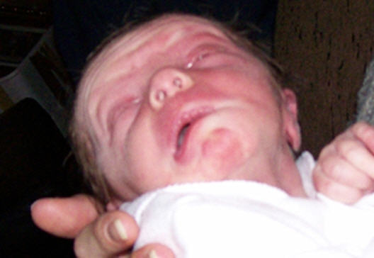 World's Ugliest Babies