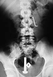 Funny and Weird X-rays