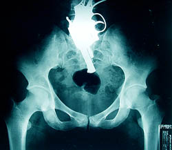 Funny and Weird X-rays