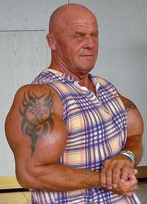 Victims of Synthol - False Kings of Body Building