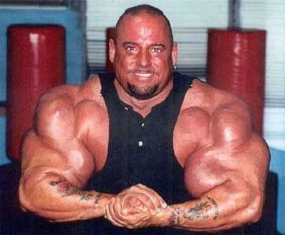 Victims of Synthol - False Kings of Body Building