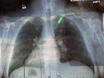 Jesus like chilling in smokers lungs sometimes