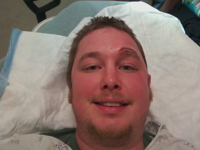 After the stitches