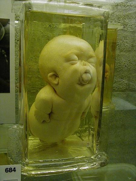 Disturbing Bottle Babies