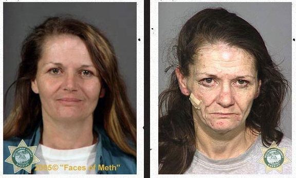 Meth Death Before and After