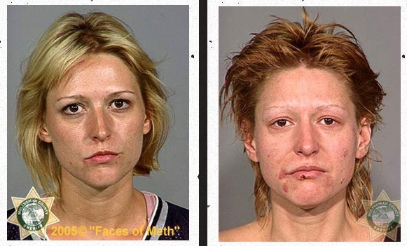 Meth Death Before and After