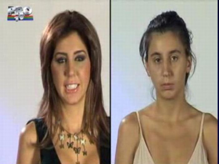 Befor and After Plastic Surgery