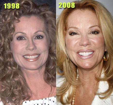 Celebrity Plastic Surgery