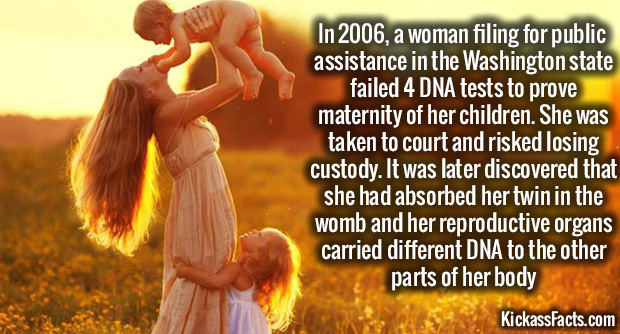 Unbelievable - In 2006, a woman filing for public assistance in the Washington state failed 4 Dna tests to prove maternity of her children. She was taken to court and risked losing custody. It was later discovered that she had absorbed her twin in the wom