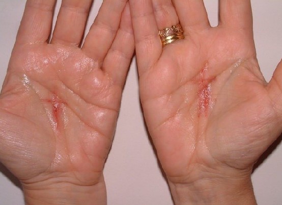 stigmata - real or fake?