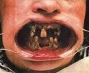 Worst teeth in the world!