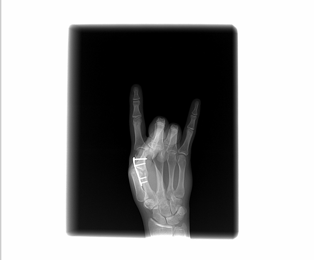 Amazing X-Ray Pics