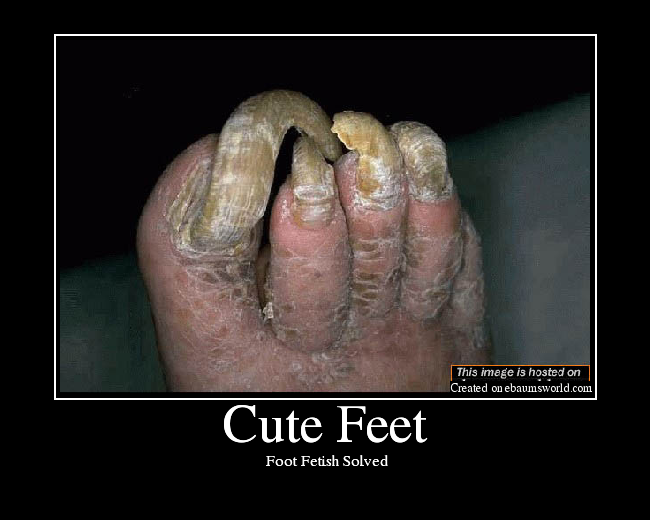  Foot Fetish Solved