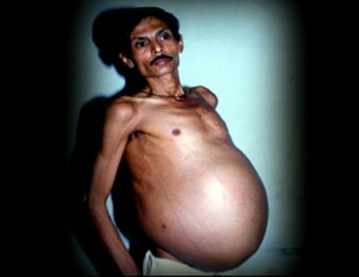 pregnant indian man