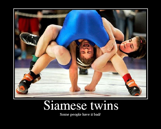 Siamese Twins Picture Ebaum S World