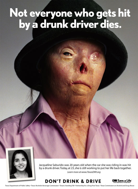Living proof of what Drunk Driving can do to others.