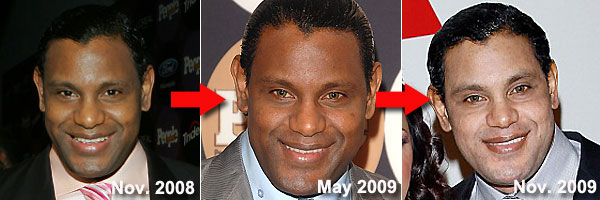 What the hell happened to Sammy Sosa's face?