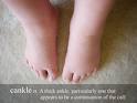 Cankles