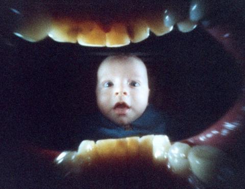Pictures from inside the mouth