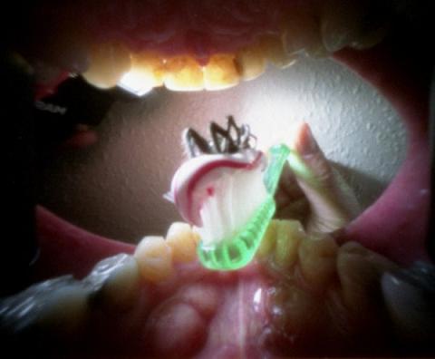 Pictures from inside the mouth