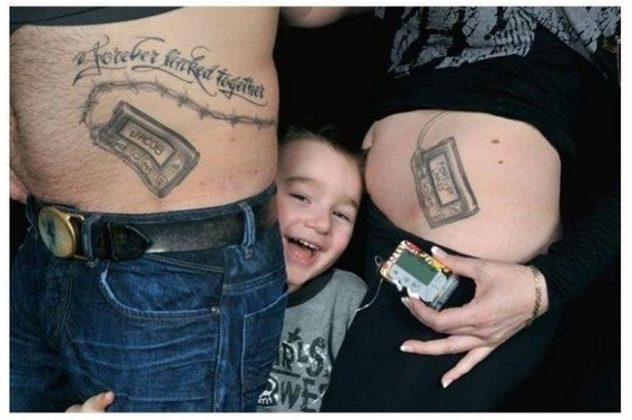The parents who tattooed insulin pumps on their bellies so their diabetic son wouldn't feel "different"