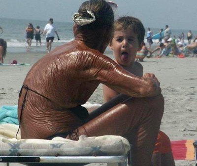 After seeing this I bet you'll never forget to wear sun-screen again. 