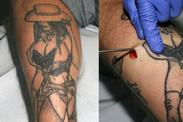 Tattoo's w Breast Implants