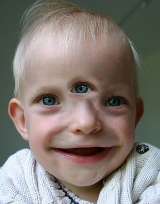 kid with 3 eyes