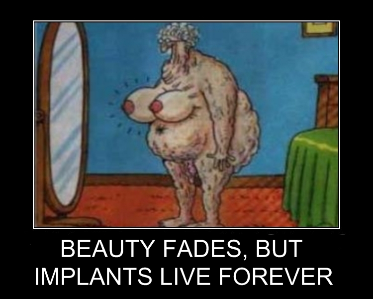 BUT IMPLANTS LAST FOREVER