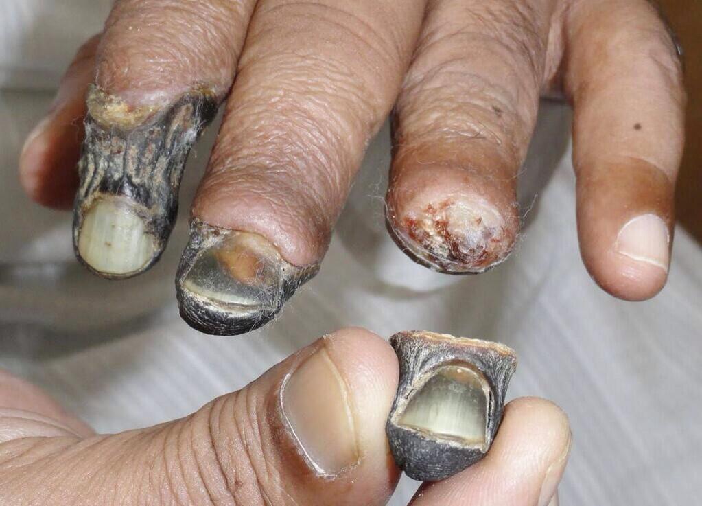 Kilgore's Nocturnal Exposition