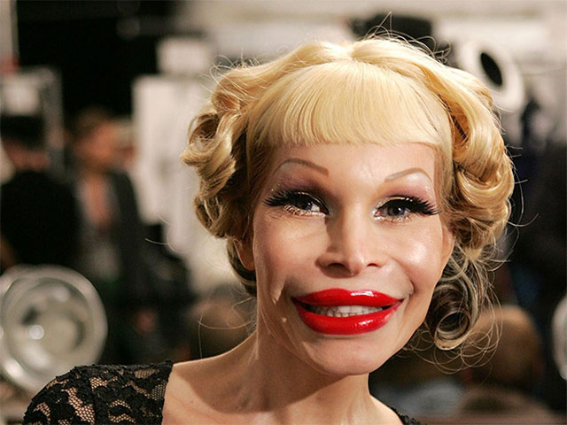 These Plastic Surgery Nightmares Will Haunt Your Dreams