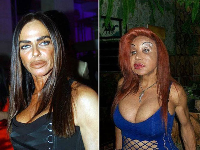 These Plastic Surgery Nightmares Will Haunt Your Dreams