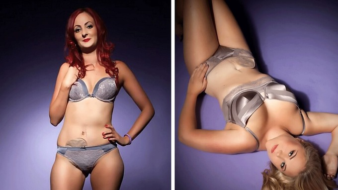 Crohn's Disease Sufferers Strip Off For Raunchy Lingerie Calendar To Prove Stoma Bags Can Be Sexy