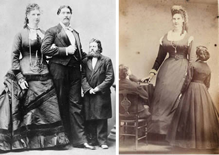 The World's Biggest Vagina most likely belonged to Scottish giantess Anna Swan (1846-1888), a remarkable woman who set a number of records relating to her bulk. Born normally sized, she began growing at a prodigious rate in childhood, finally reaching a maximum height of 7' 8" at age 19.