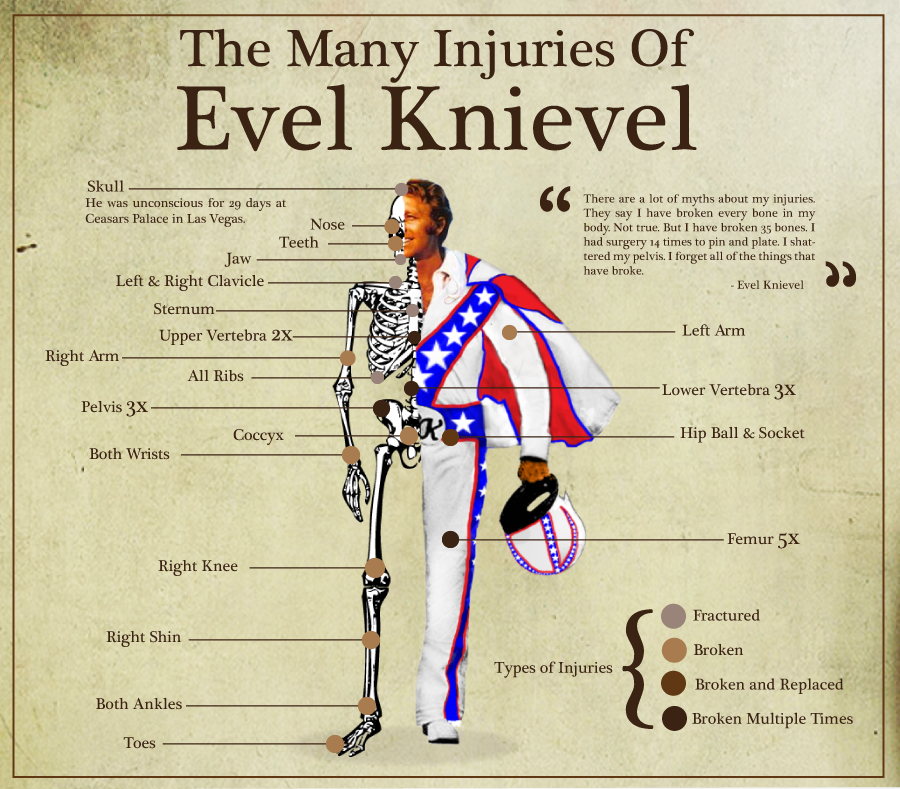 many injuries of evel knievel - The Many Injuries Of Evel Knievel There are a lot of myths about my muries They say I have been very bone in my body. Not toe. But I have broken bones! hand surgery time to pin and plate Isha y pelvis for all of the things 