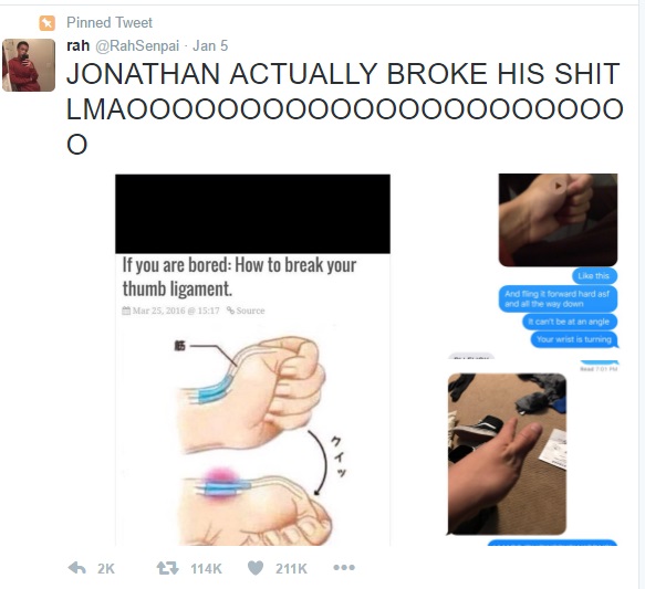 People are taking to Twitter to show off their dislocated thumbs. All thanks to this meme.