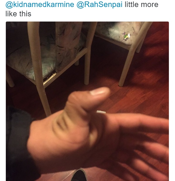 Twittidiots Are Breaking Their Thumbs On Purpose