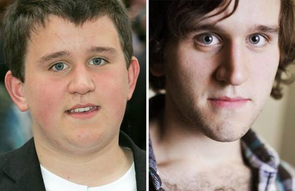 Harry Melling
’’Harry Potter and the Philosopher’s Stone’’ – Dudley (2001)