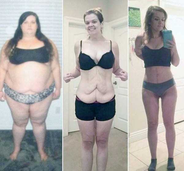 Weight loss keto before and after women