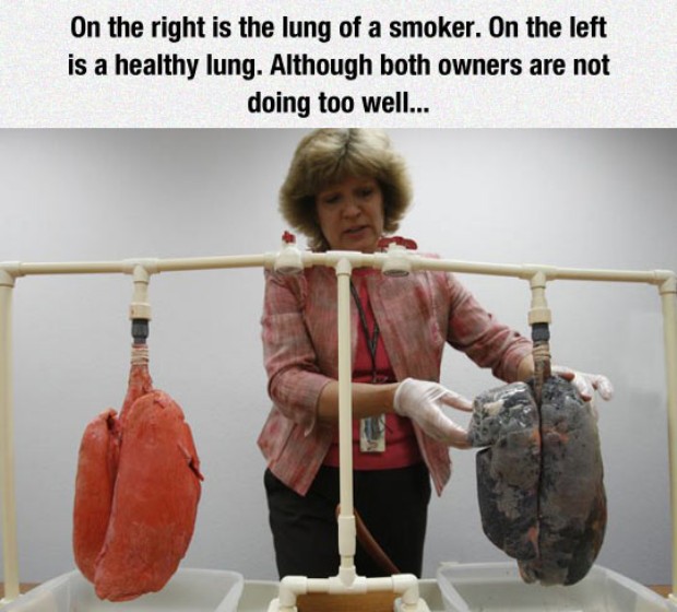 funny smoker - On the right is the lung of a smoker. On the left is a healthy lung. Although both owners are not doing too well...