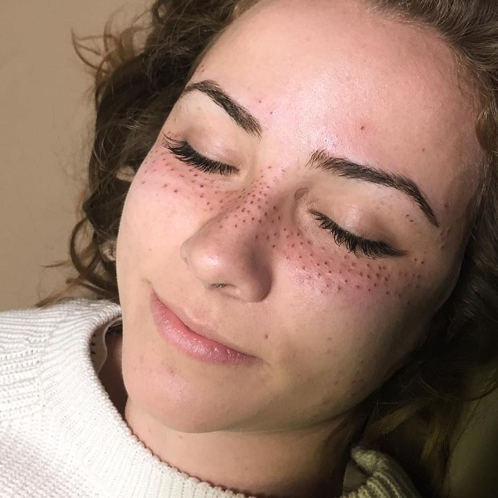 Girls Are Having Freckles Tattooed On Their Faces With New Beauty Trend