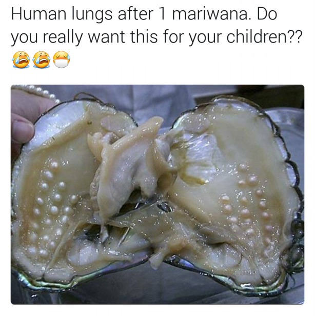 oyster with many pearls - Human lungs after 1 mariwana. Do you really want this for your children??