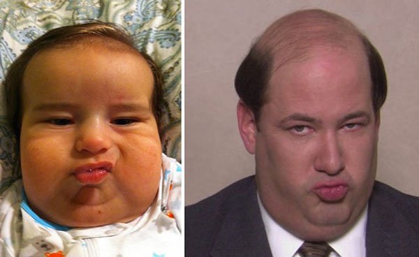 Baby pattern baldness is a thing. Just ask baby Kevin from The Office.