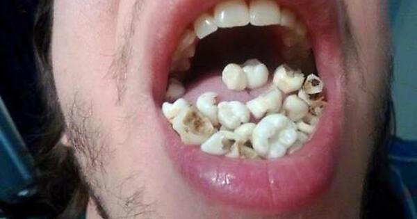 cursed teeth