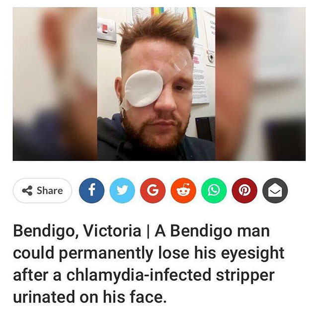 chlamydia meme - Go Ooo Bendigo, Victoria A Bendigo man could permanently lose his eyesight after a chlamydiainfected stripper urinated on his face.