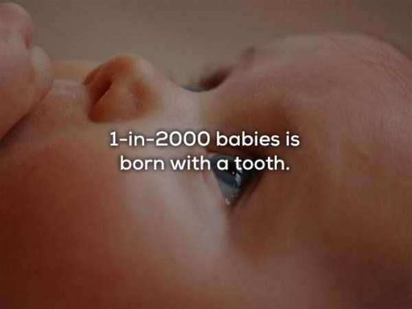 close up - 1in2000 babies is born with a tooth.